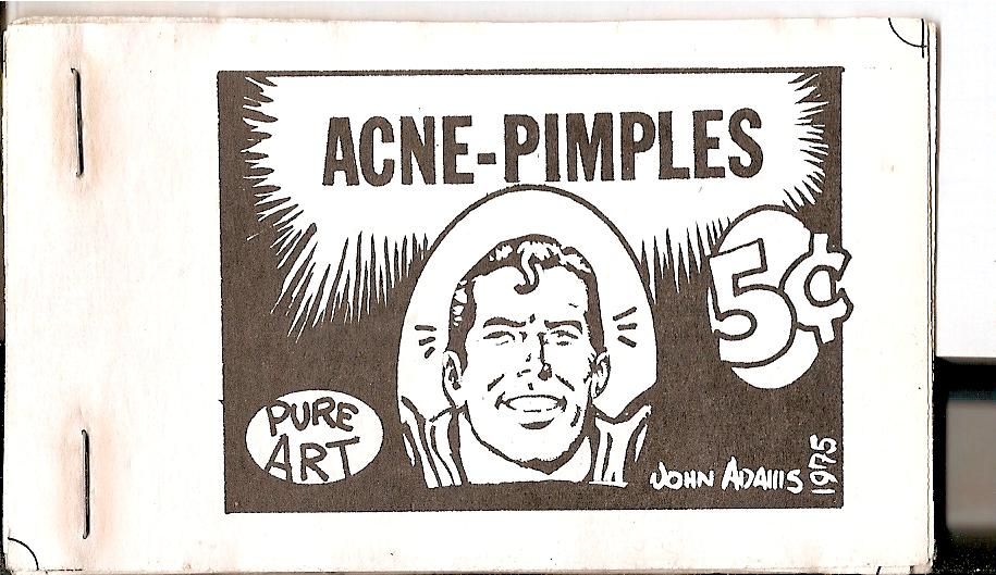 acne_pimples.jpg