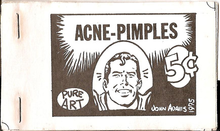 acne-pimples.jpg
